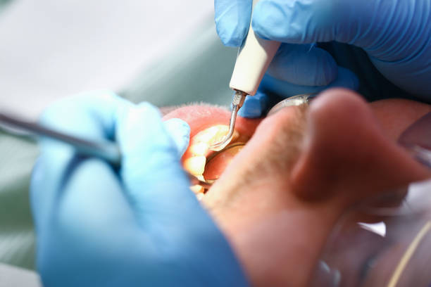 Best Weekend Emergency Dentist in Apison, TN