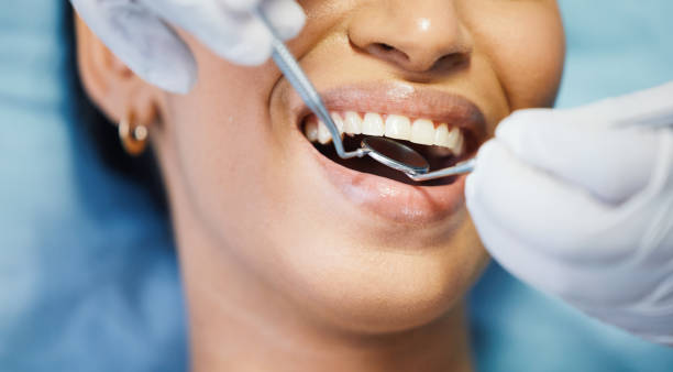 Best Emergency Dental Services for Seniors in Apison, TN